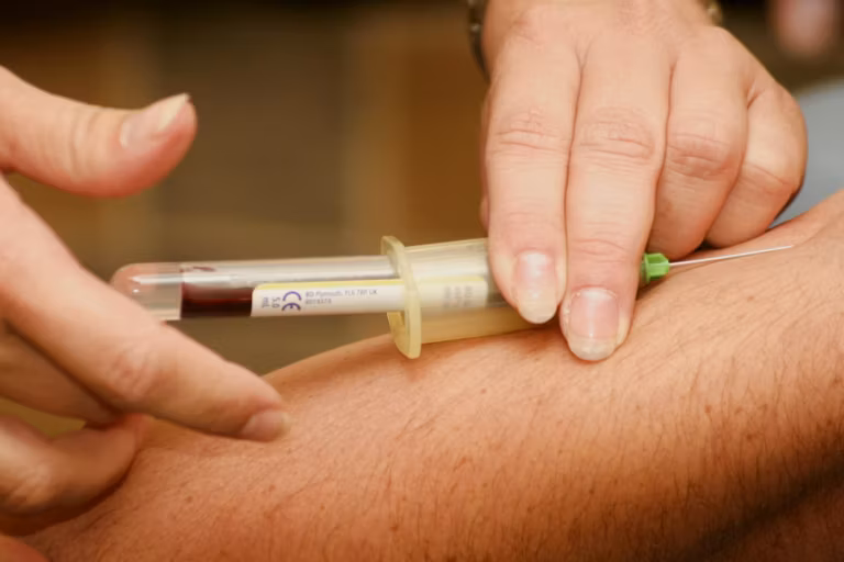 A blood sample being drawn from an arm into a small tube for a screening test